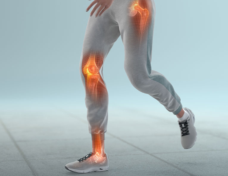 legs-with-pain-points